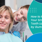 How to Restore Your Smile After Tooth Loss Caused by Gum Disease