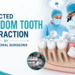 Impacted Wisdom Tooth Extraction by Expert Oral Surgeons