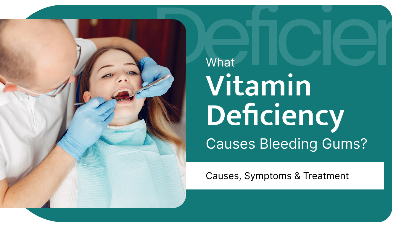 What vitamin deficiency causes bleeding gums